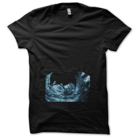 Tee shirt echographie femme enceinte noir