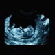 T-shirt ultrasound pregnant woman black